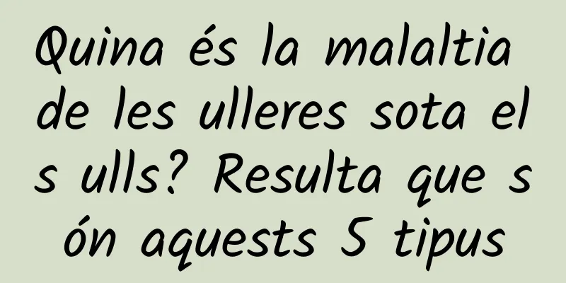 Quina és la malaltia de les ulleres sota els ulls? Resulta que són aquests 5 tipus