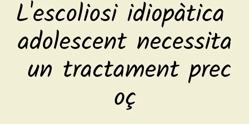 L'escoliosi idiopàtica adolescent necessita un tractament precoç