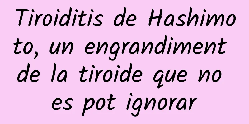 Tiroiditis de Hashimoto, un engrandiment de la tiroide que no es pot ignorar