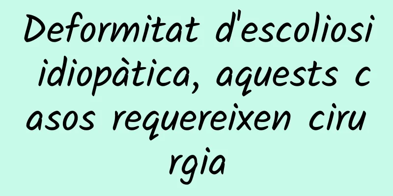 Deformitat d'escoliosi idiopàtica, aquests casos requereixen cirurgia