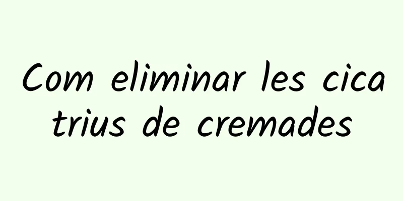 Com eliminar les cicatrius de cremades