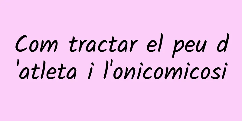 Com tractar el peu d'atleta i l'onicomicosi