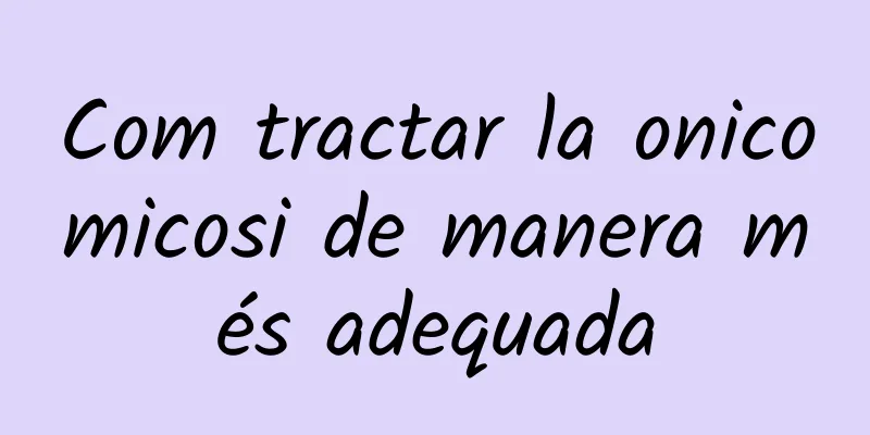 Com tractar la onicomicosi de manera més adequada