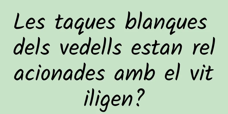 Les taques blanques dels vedells estan relacionades amb el vitiligen?
