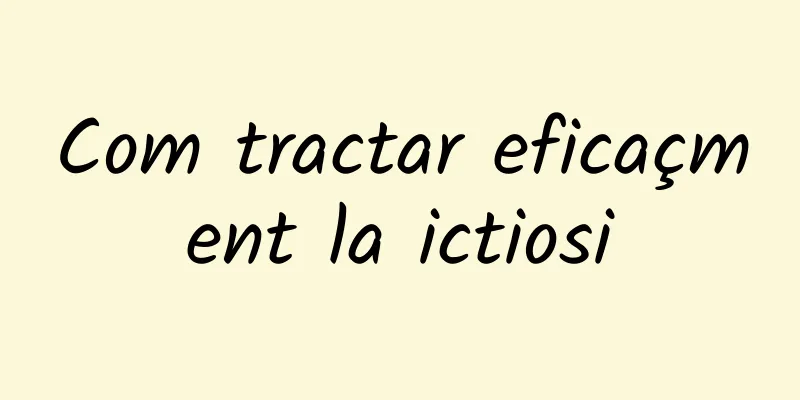 Com tractar eficaçment la ictiosi