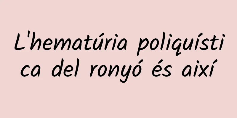 L'hematúria poliquística del ronyó és així