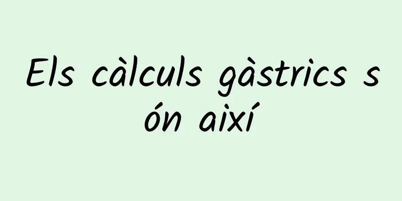 Els càlculs gàstrics són així