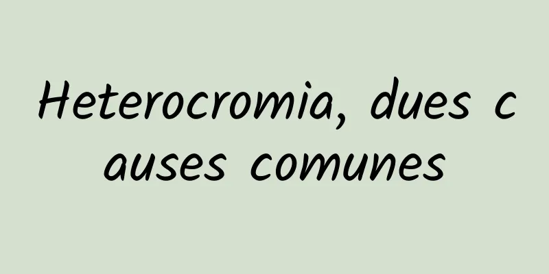 Heterocromia, dues causes comunes