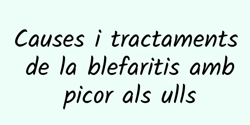 Causes i tractaments de la blefaritis amb picor als ulls
