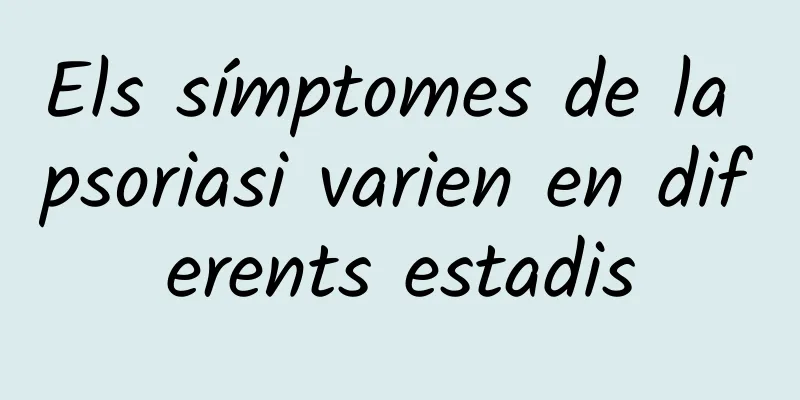 Els símptomes de la psoriasi varien en diferents estadis