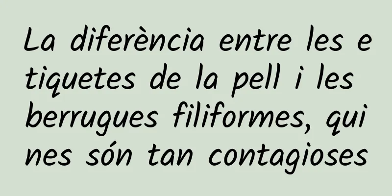 La diferència entre les etiquetes de la pell i les berrugues filiformes, quines són tan contagioses