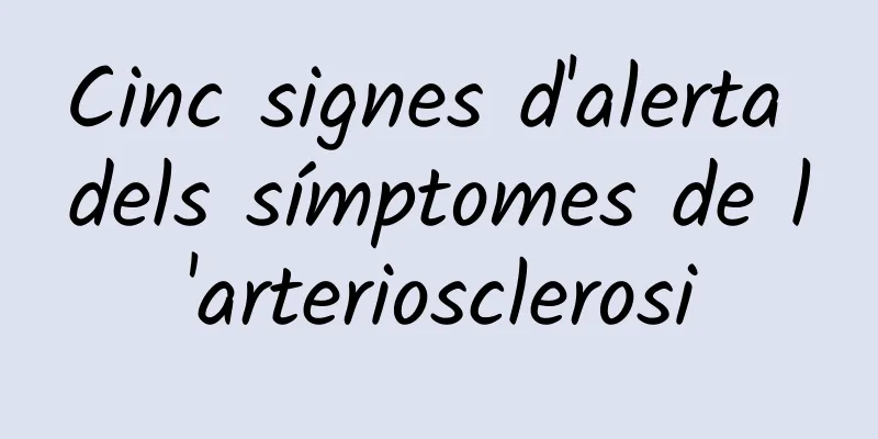 Cinc signes d'alerta dels símptomes de l'arteriosclerosi