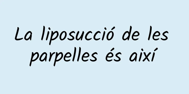 La liposucció de les parpelles és així