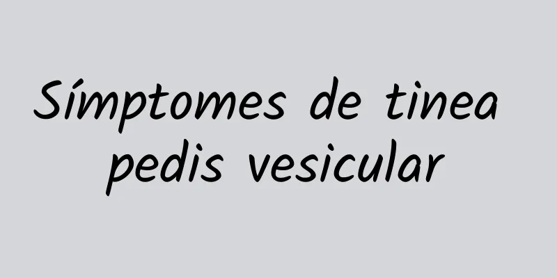 Símptomes de tinea pedis vesicular