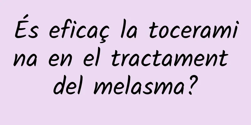 És eficaç la toceramina en el tractament del melasma?