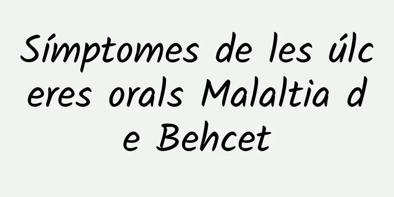 Símptomes de les úlceres orals Malaltia de Behcet
