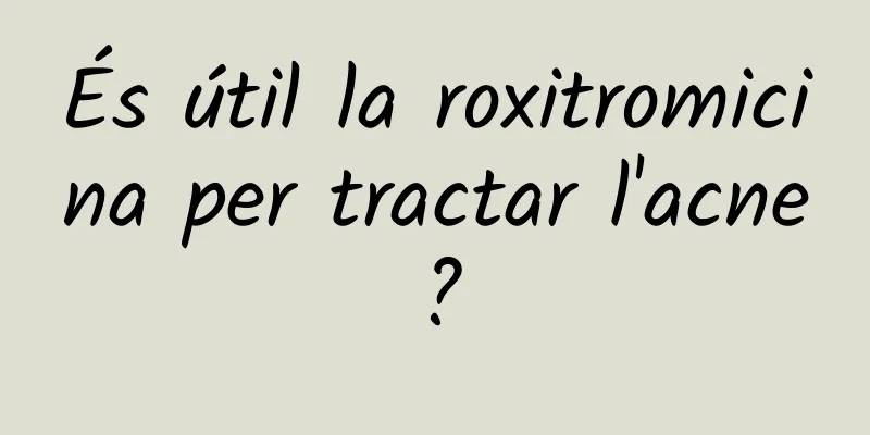 És útil la roxitromicina per tractar l'acne?