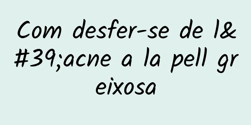 Com desfer-se de l'acne a la pell greixosa