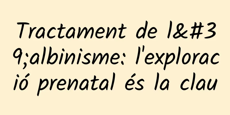 Tractament de l'albinisme: l'exploració prenatal és la clau