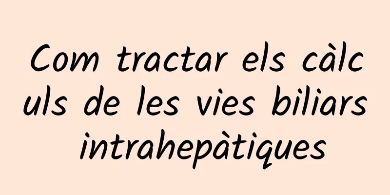 Com tractar els càlculs de les vies biliars intrahepàtiques