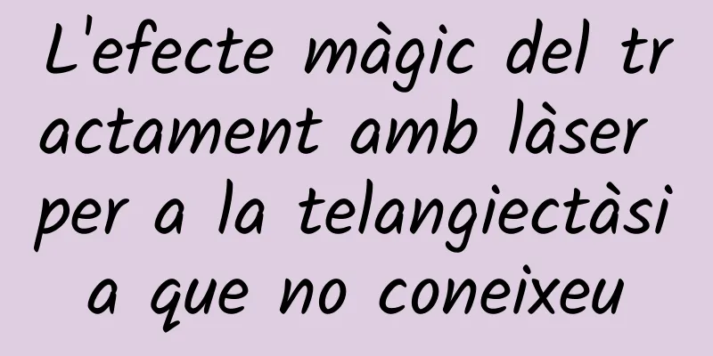 L'efecte màgic del tractament amb làser per a la telangiectàsia que no coneixeu