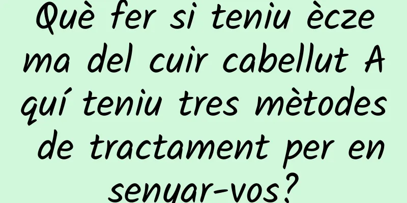 Què fer si teniu èczema del cuir cabellut Aquí teniu tres mètodes de tractament per ensenyar-vos?