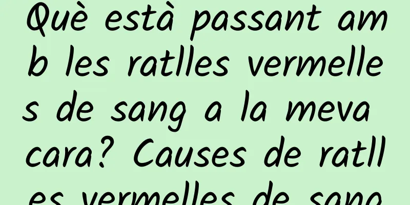 Què està passant amb les ratlles vermelles de sang a la meva cara? Causes de ratlles vermelles de sang