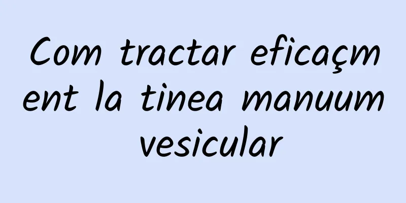 Com tractar eficaçment la tinea manuum vesicular