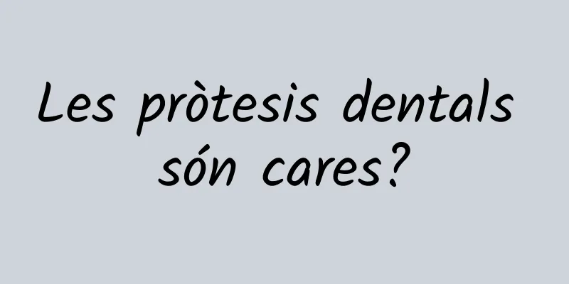 Les pròtesis dentals són cares?
