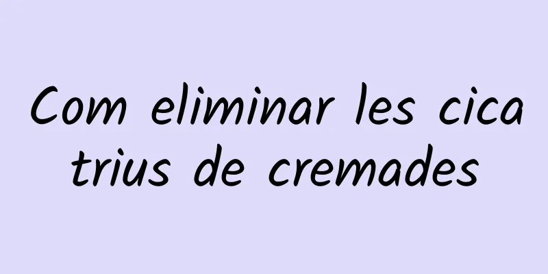 Com eliminar les cicatrius de cremades