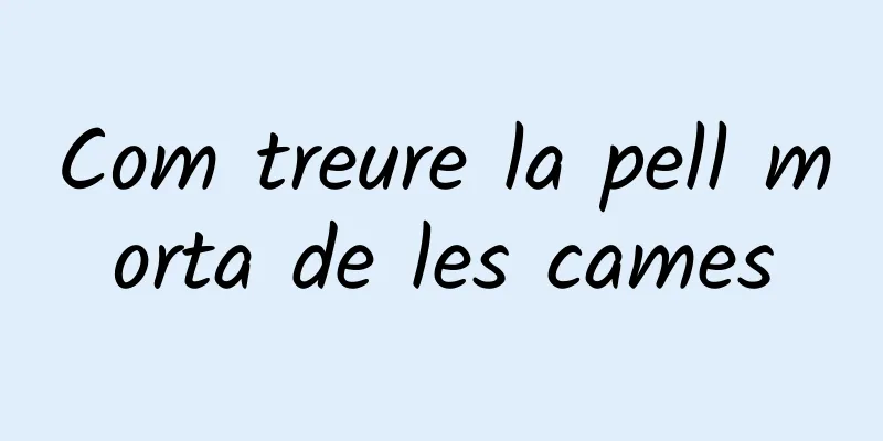 Com treure la pell morta de les cames