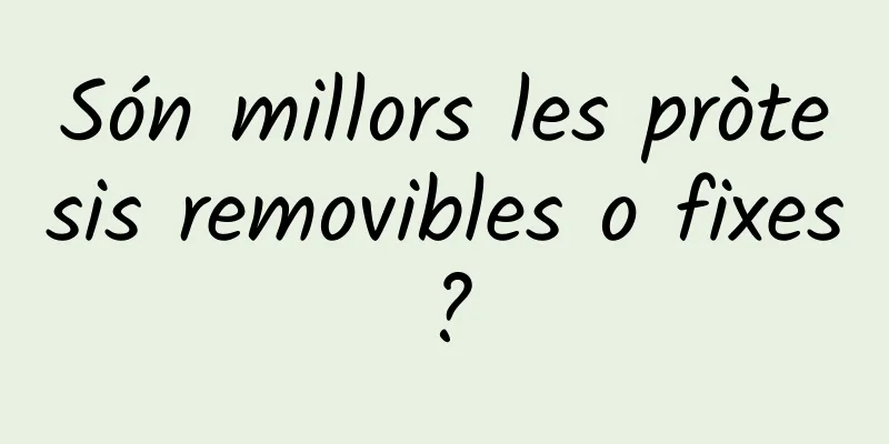 Són millors les pròtesis removibles o fixes?