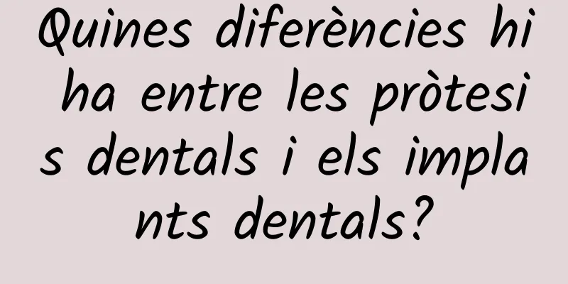 Quines diferències hi ha entre les pròtesis dentals i els implants dentals?