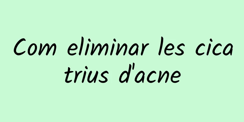 Com eliminar les cicatrius d'acne