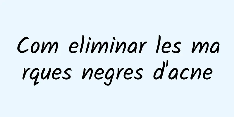 Com eliminar les marques negres d'acne