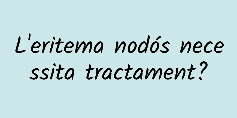 L'eritema nodós necessita tractament?