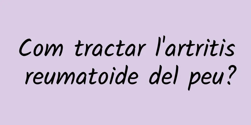 Com tractar l'artritis reumatoide del peu?