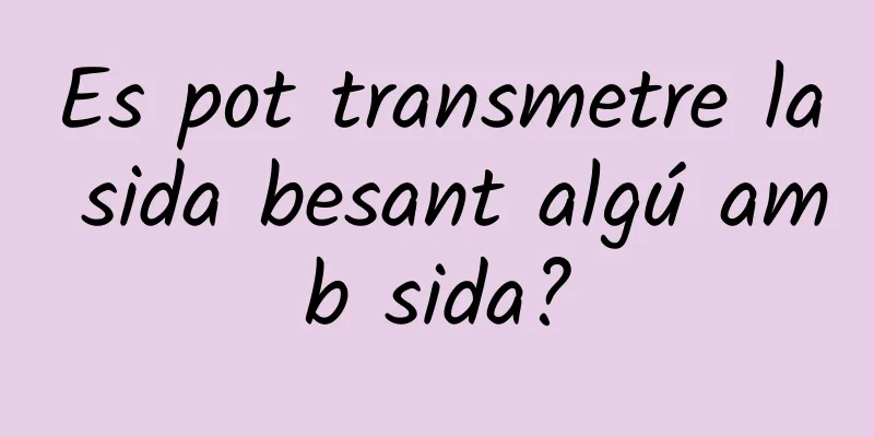 Es pot transmetre la sida besant algú amb sida?