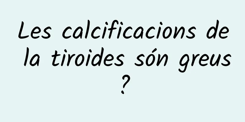 Les calcificacions de la tiroides són greus?