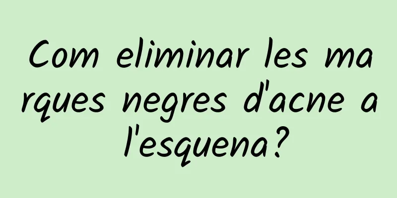 Com eliminar les marques negres d'acne a l'esquena?