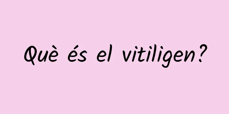 Què és el vitiligen?