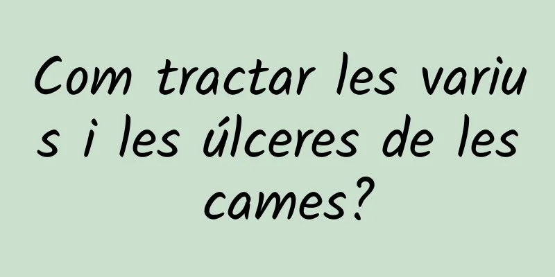 Com tractar les varius i les úlceres de les cames?