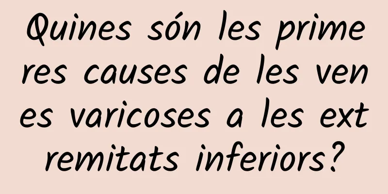 Quines són les primeres causes de les venes varicoses a les extremitats inferiors?