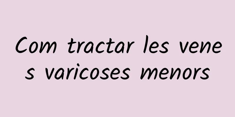 Com tractar les venes varicoses menors