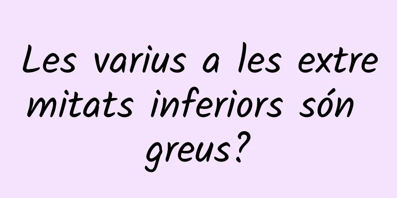 Les varius a les extremitats inferiors són greus?