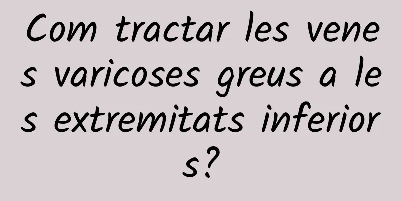 Com tractar les venes varicoses greus a les extremitats inferiors?