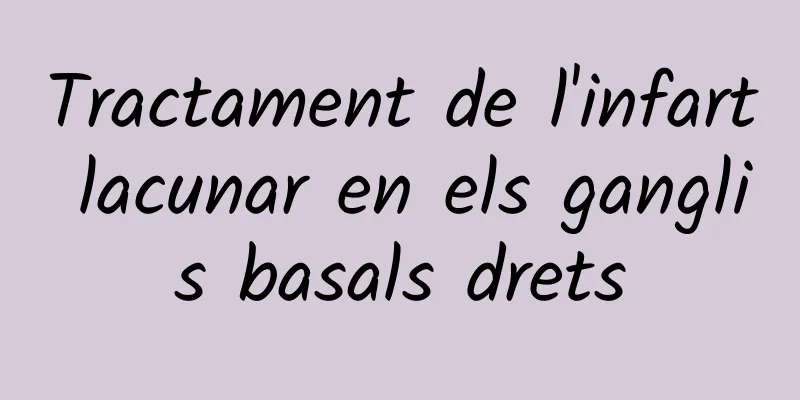 Tractament de l'infart lacunar en els ganglis basals drets