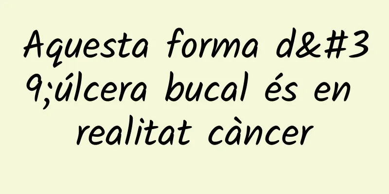 Aquesta forma d'úlcera bucal és en realitat càncer