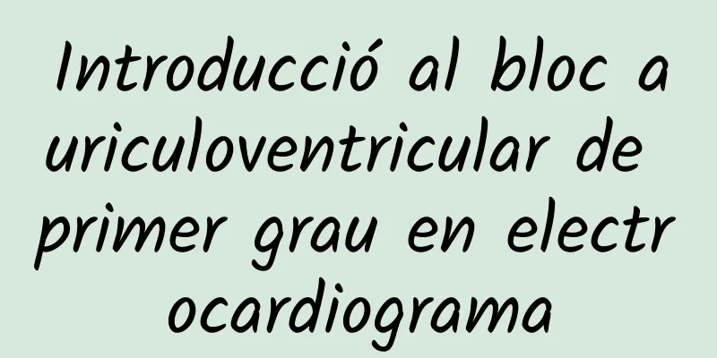 Introducció al bloc auriculoventricular de primer grau en electrocardiograma
