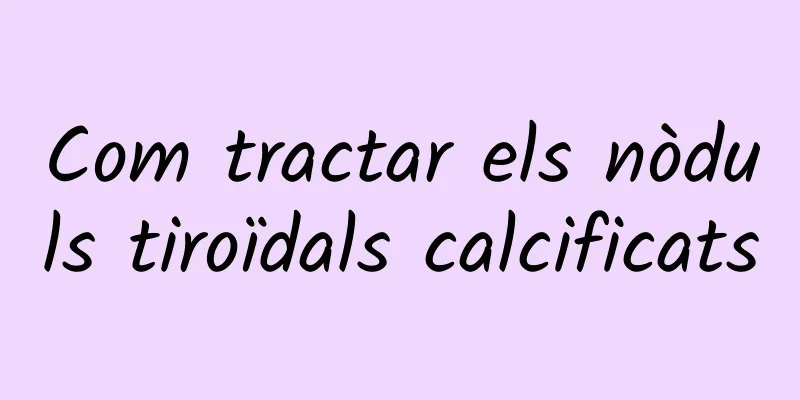 Com tractar els nòduls tiroïdals calcificats